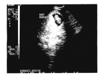 sept102003lores1 sept102003lores1